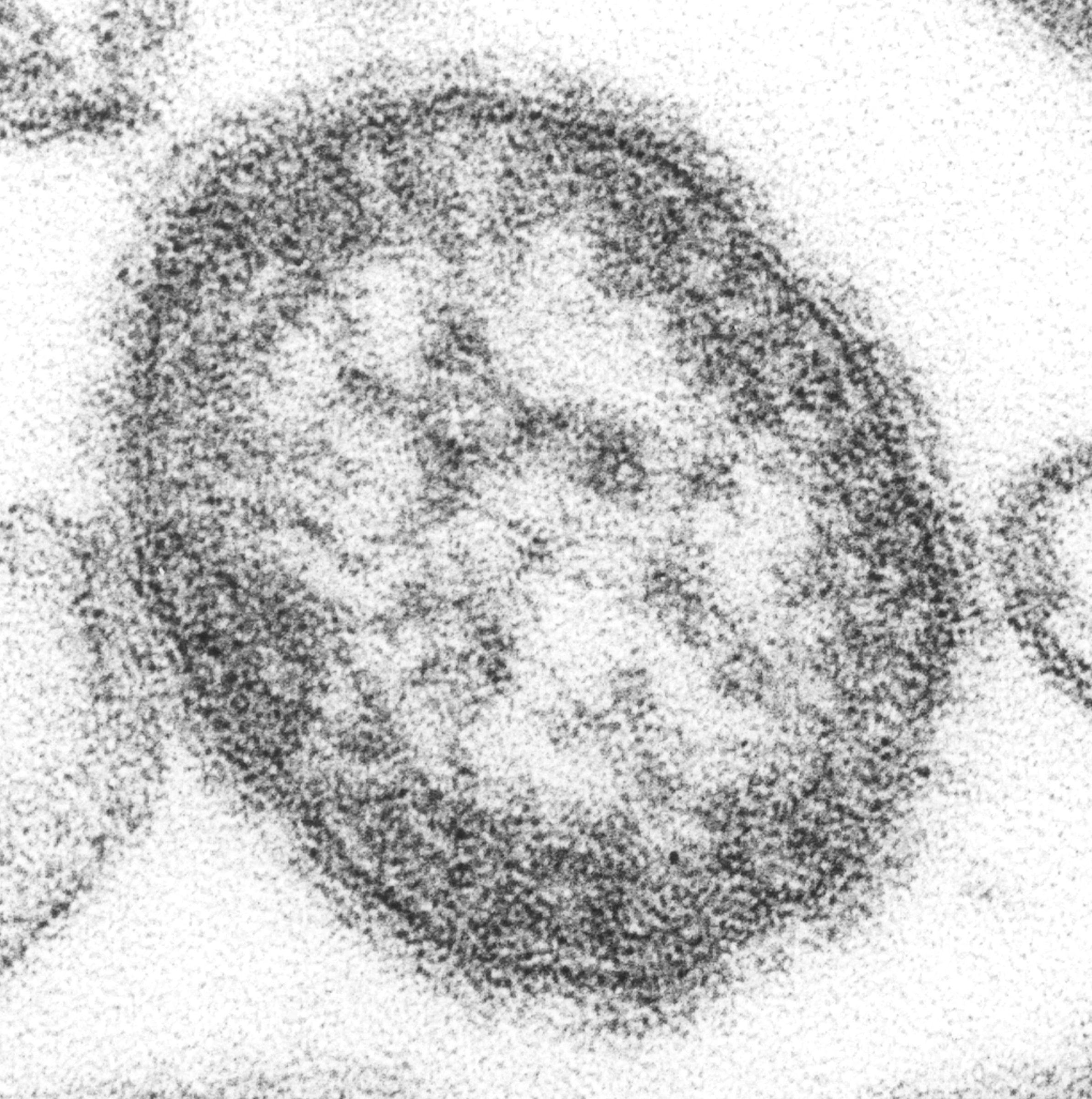 A grayscale transmission electron micrograph shows a single measles virus particle.